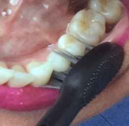 Image Title My Image