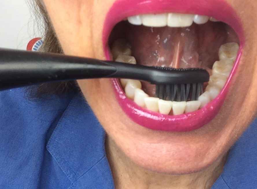 Image Title My Image